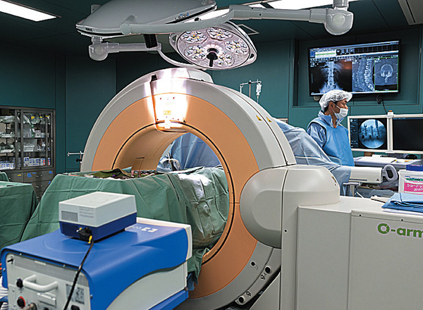Ｏアーム　手術中に使用するモバイル型CT
