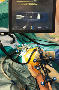手術支援システムのアームロボットは、効率的に的確な骨を削ることができる