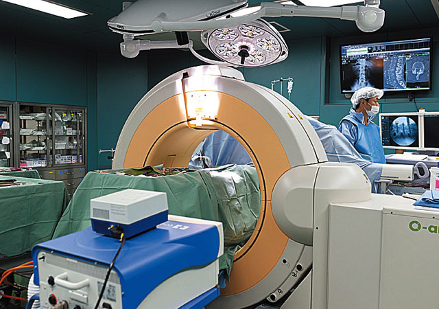■Ｏアーム　手術中に使用するモバイル型CT。ナビゲーションシステムと連動して、安全で高精度の手術を可能にする。