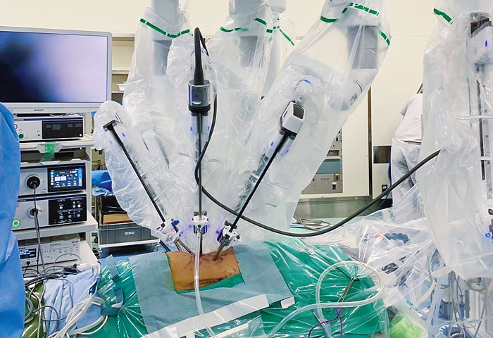 ロボット支援下小児腎盂（じんう）形成術