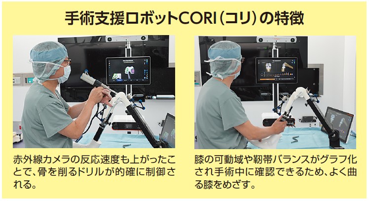 手術支援ロボットCORI（コリ）の特徴