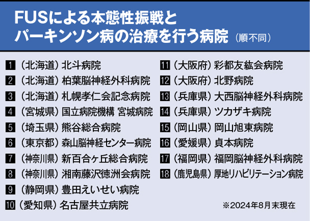 FUSによる本態性振戦とパーキンソン病の治療を行う病院